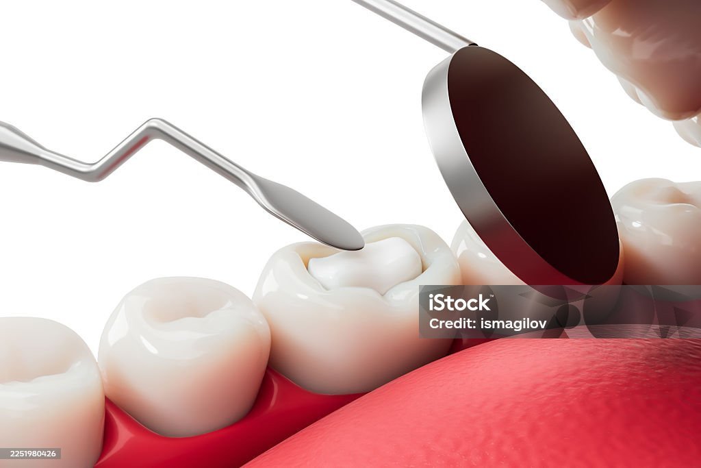 Composite light cure