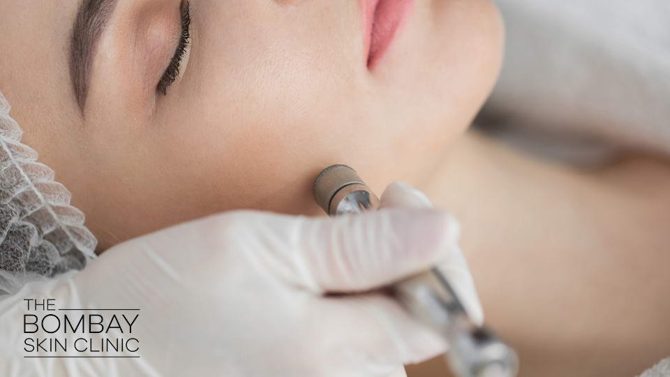 Diamond Facial