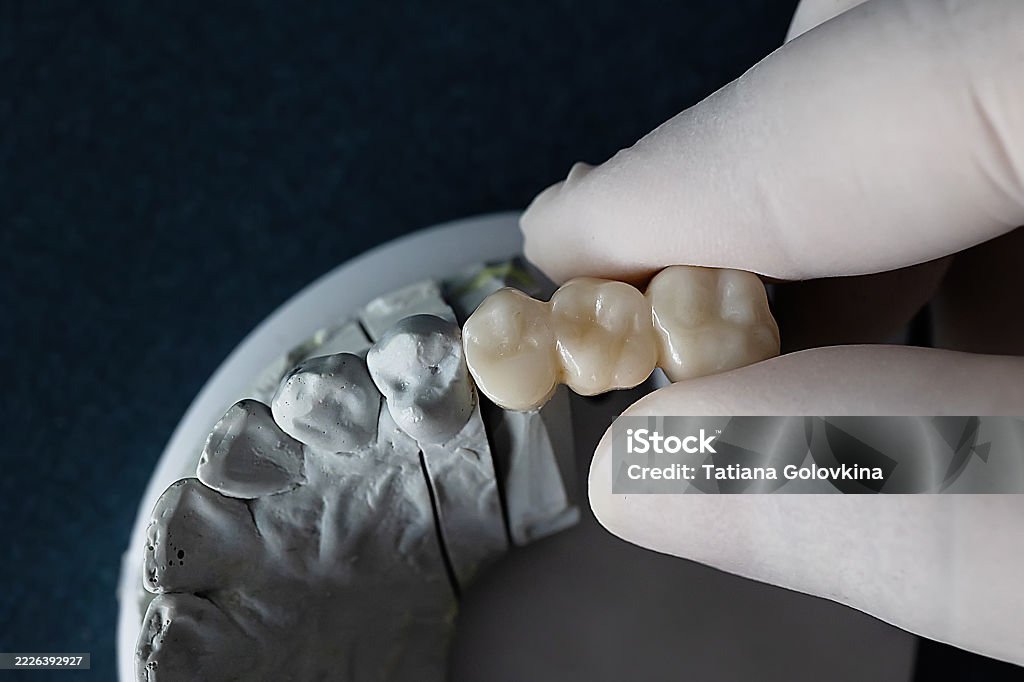 Zirconia CAD/CAM