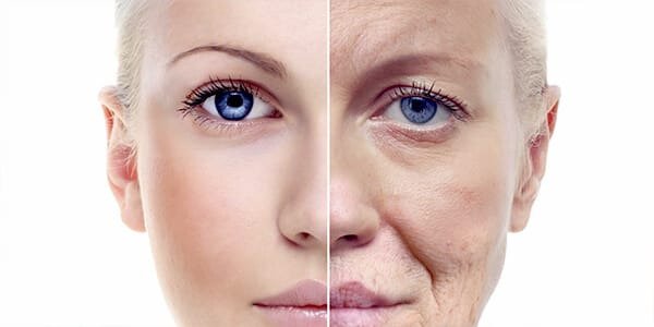Anti-Aging Peel