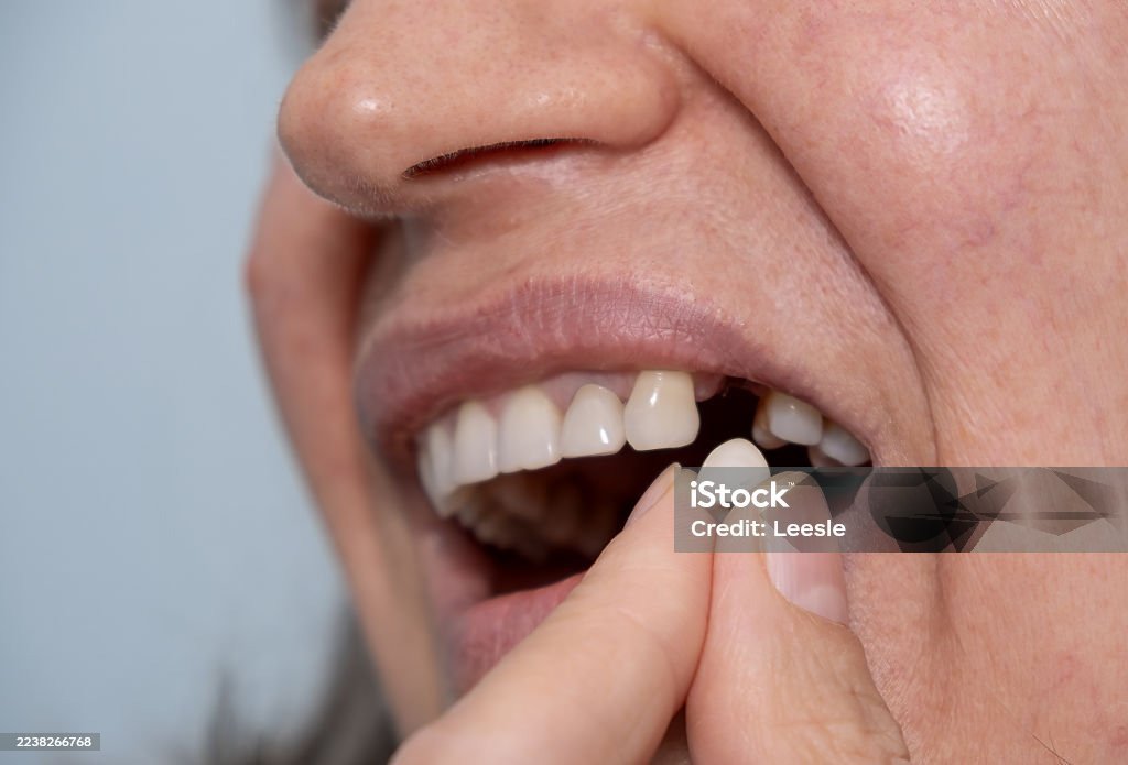 Zirconia HYBRID