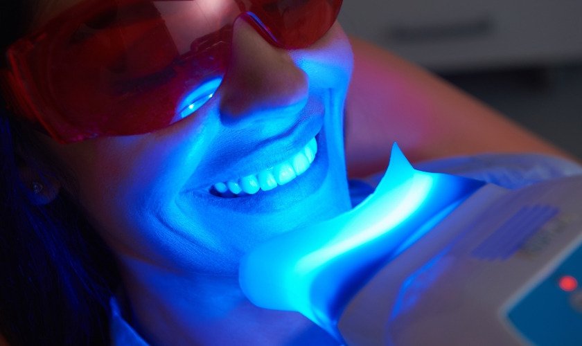 Laser tooth whitening