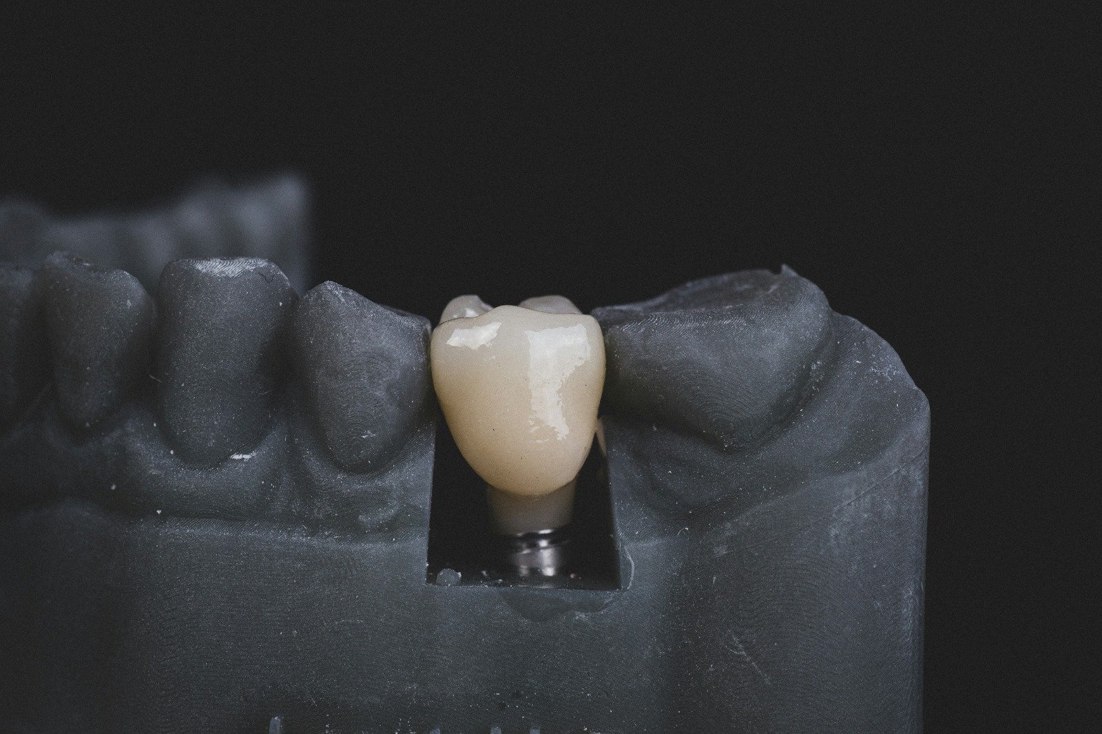 Implant(Chinese)
